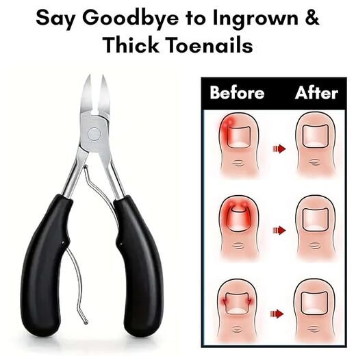 Nail Clipper - Image 3