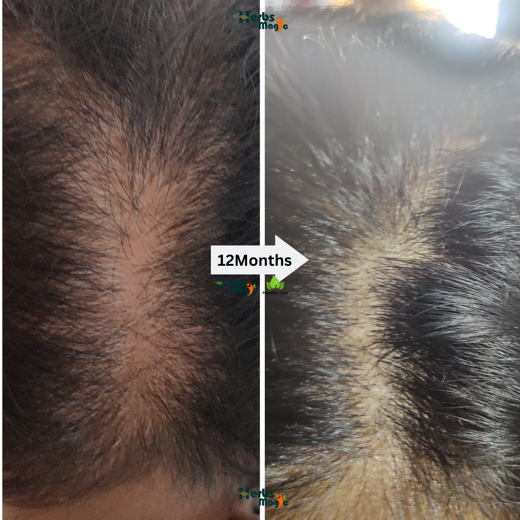 Herbs Magic Ayurvedic Kesh Kalpa Hair Mask | Complete Hair Care for increasing Hair Fall - Image 4