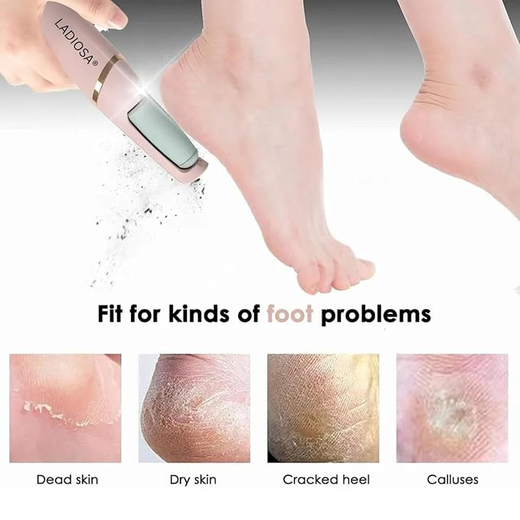 Pedicure Tool - Image 3