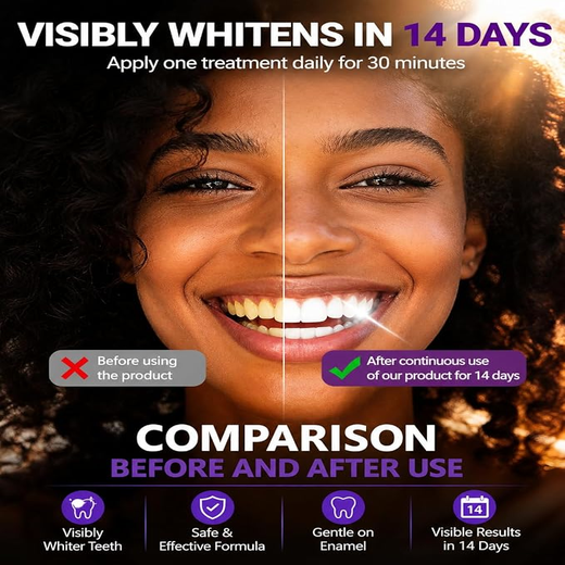 Purple Teeth Whitening Strips (Pack of 1) - Image 4