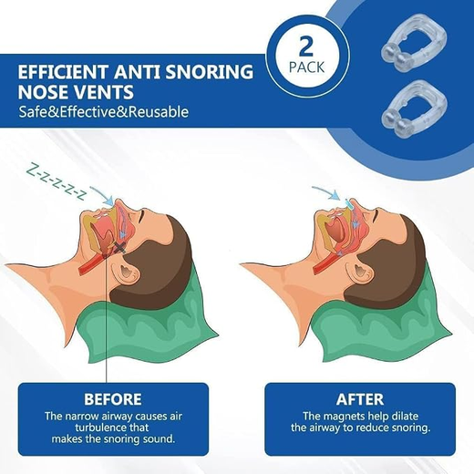 Snore Nose Clip - Image 4