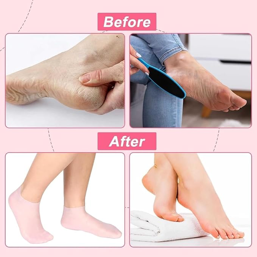 Silicone Moisturizing Gel Socks - Image 2