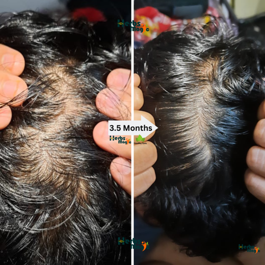 Herbs Magic Keshavriddhi Hair Oil | Hair Fall Control and Hair Growth with Bringharaj & Hibiscus - Image 4