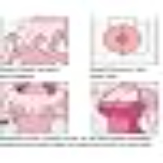 SILICONE BREAST LIFT FLOWER - Image 4