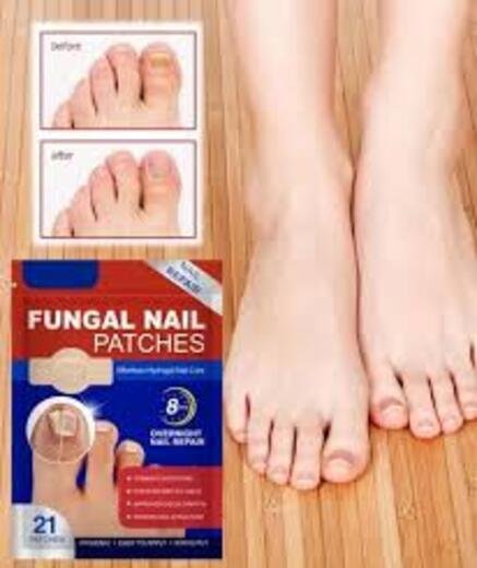 Fungal Nail Patch - Image 2