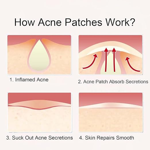 Skin Tag Acne Patch Dots (72 pcs) - Image 4