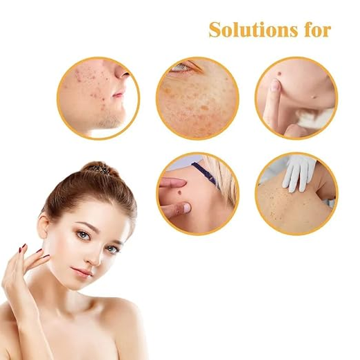 Skin Tag Acne Patch Dots (72 pcs) - Image 2