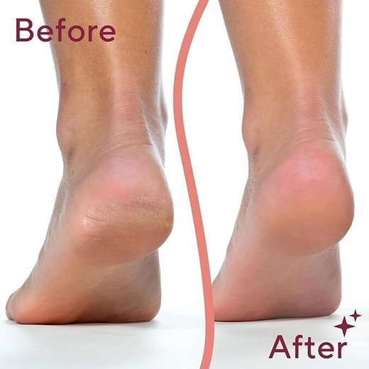 Rechargable Flawless Pedicure - Image 3