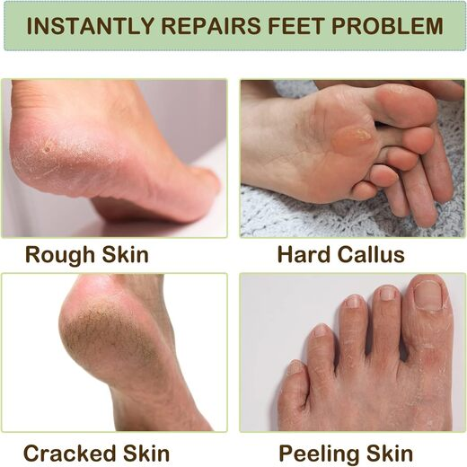 Spa Gel Socks - Image 3