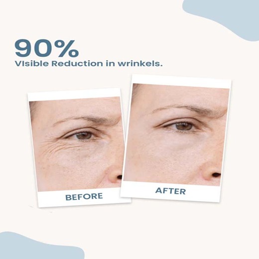 Earthraga HA + Retinol Night Cream with Niacinamide & Aquaxyl | 50 gm - Image 2