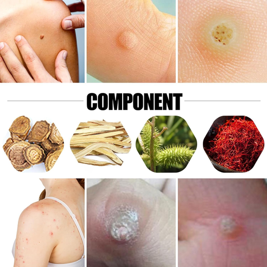 Foot Corn Remover (Pack of 8) - Image 4