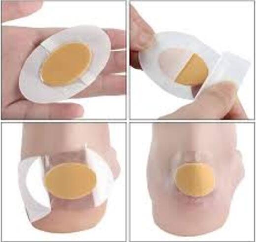 Heel Blister - Image 4