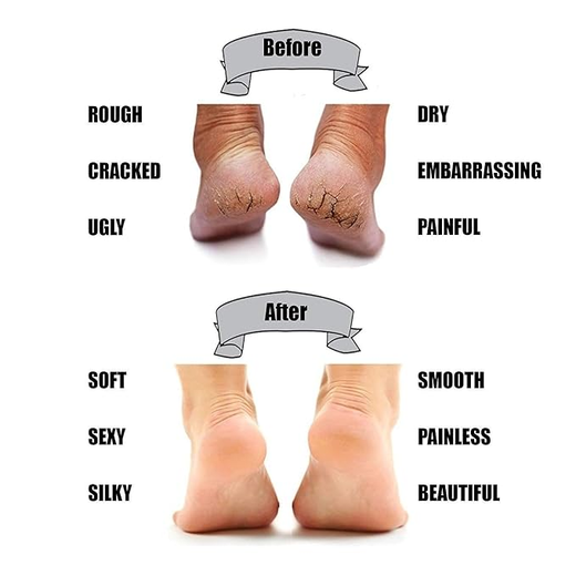 Cotton Heel Relief - Image 3