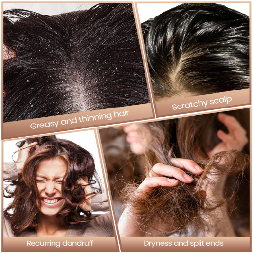 DANDRUFF REMOVAL COMB - Image 3