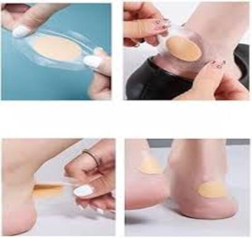 Heel Blister - Image 2