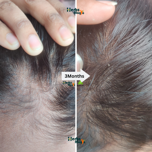 Herbs Magic Ayurvedic Keshavriddhi Hair Oil & Kesh Kalpa Hair Mask | Complete Hair Care combo for increasing Hairfall - Image 4