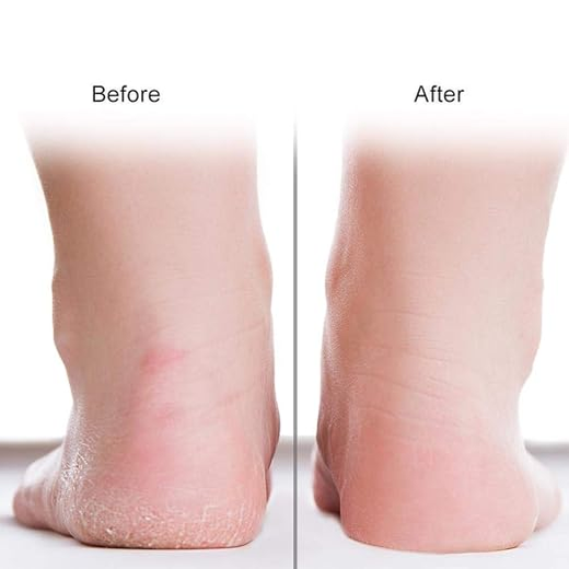 New Silicone Full Heel Socks - Image 3