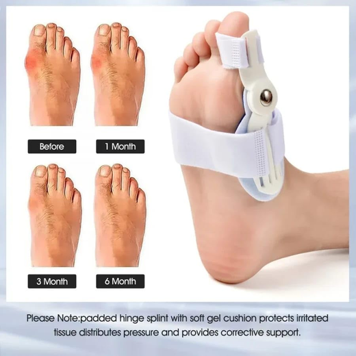 Toe Straightener - Image 3