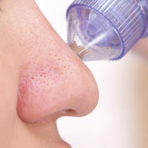 Derma Suction - Image 2
